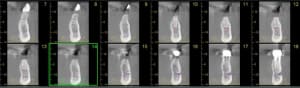 Scanner 34 avec un 8 mm coupe ozt7vu - Eugenol
