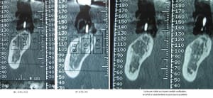 Scanner lvox2w - Eugenol