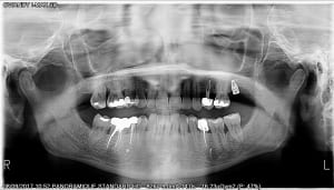 Serret 13 sept 2017 ni2odb - Eugenol