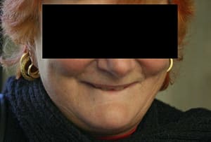 Sourire face yqtgph - Eugenol