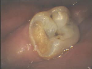 Tarc2 pnbu74 - Eugenol