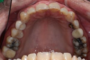 Tcjwyiazc1a3jg3ncm4e - Eugenol