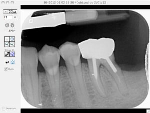 Tenon nmzbhi - Eugenol