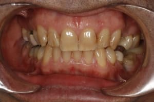 Test 2 ndzlxf - Eugenol
