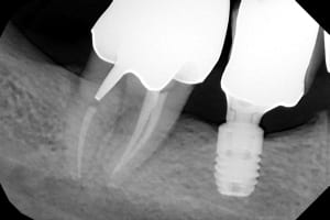 Tmbio5tsfirad5a8jjmtmd50jmqq - Eugenol