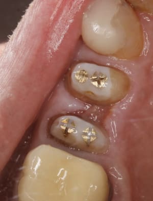 Tn4m8at9zh49dxs21yujjfmlccg7 - Eugenol