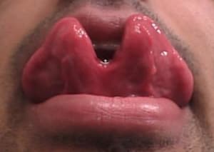 Tonguesplit xcwtb5 - Eugenol