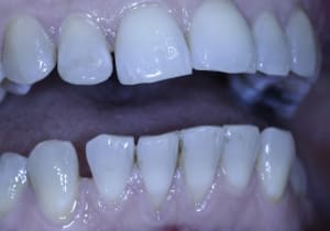 Trop clair isbf8o - Eugenol