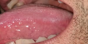 Tx1uochy4lnq4demmvah - Eugenol