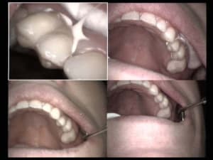 Un autre beau cas haut gauche fin 2 jjxepy - Eugenol