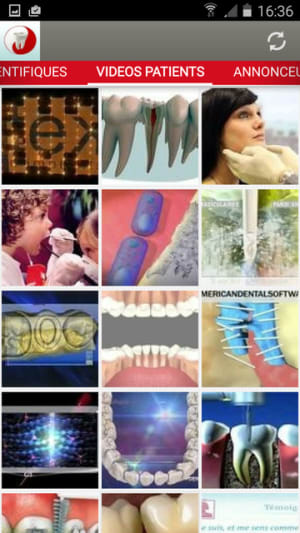 Videopatients d8bvd9 - Eugenol