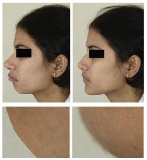 Vinette vudoax - Eugenol