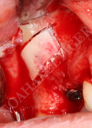 Volet repositionn  gafd4t - Eugenol