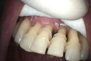 Vue vestibulaire c6orx0 - Eugenol