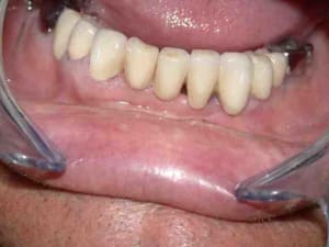 Vue vestibulaire ggzvym - Eugenol
