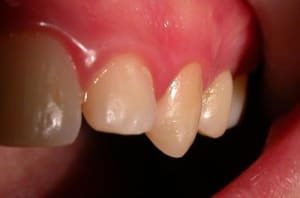 W2 va3mtd - Eugenol
