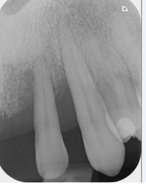 Xlvj03kubm3qxbxrwpwa - Eugenol