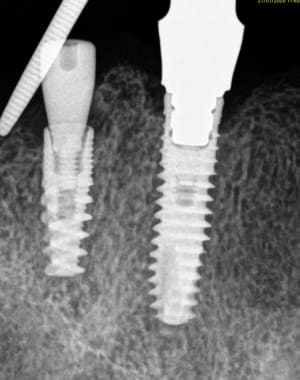 Xy69hzat72qzmtzu8pj0my8fjf3x - Eugenol