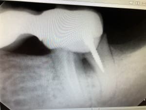 Z1vzaskkdjctkpcjt2fy - Eugenol