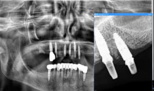 Zca9mguuhxu9rok52xi7v46or9k1 - Eugenol