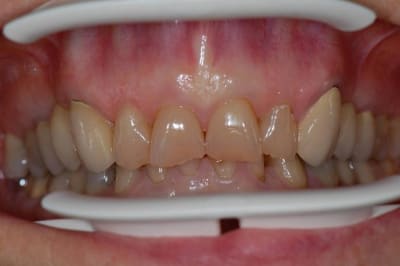 001 dhtvbp - Eugenol