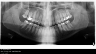 001 heg1yd - Eugenol