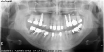 00253 p001pr ab4oy5 - Eugenol