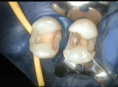 002 bgam24 - Eugenol