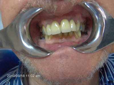 002 zoiklt - Eugenol