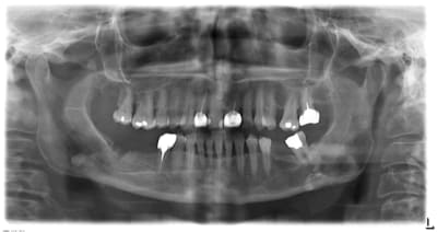 003pr fjyqfn - Eugenol