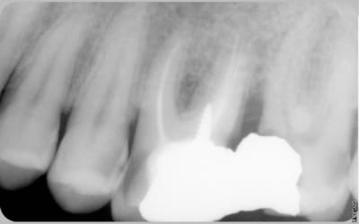 003 dppvmy - Eugenol