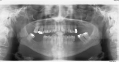 003 rrqvp8 - Eugenol