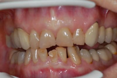 003 urjrjf - Eugenol