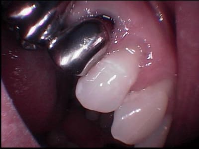 004 i4bhn5 - Eugenol