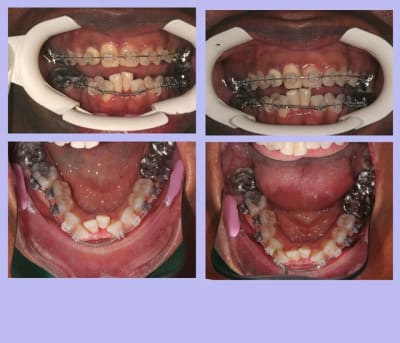 005 gmbahv - Eugenol