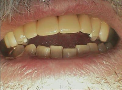 006 mbu2rc - Eugenol