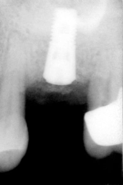 008 dsfbzw - Eugenol