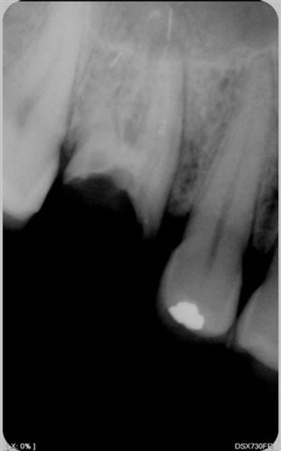 008 x5z37o - Eugenol