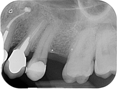 00906 x 2011 05 19 15 34 35 3 ctbof5 - Eugenol