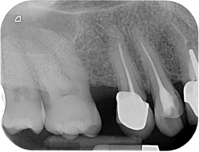 00906 x 2011 05 19 15 35 04 3 lwnnjd - Eugenol