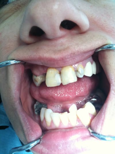 009 uw90tz - Eugenol