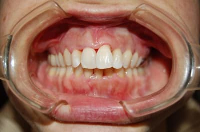 009 xfgrsf - Eugenol