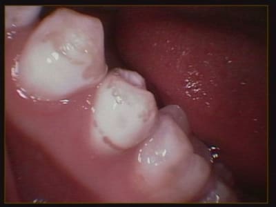 011 dqhpar - Eugenol