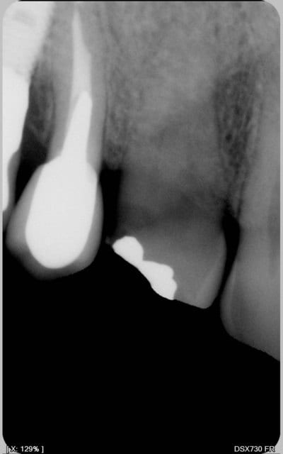 011 pksytb - Eugenol