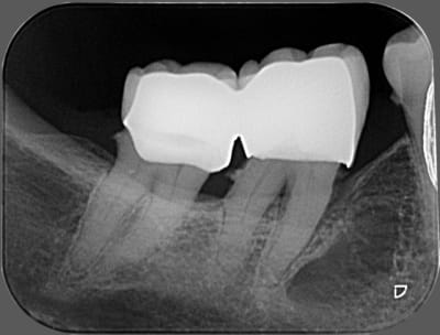 01233 x 2011 10 10 13 36 09 4 ysrste - Eugenol