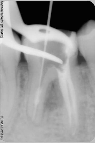 013 oltalu - Eugenol