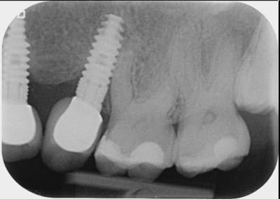 01404009 1 g3oqww - Eugenol