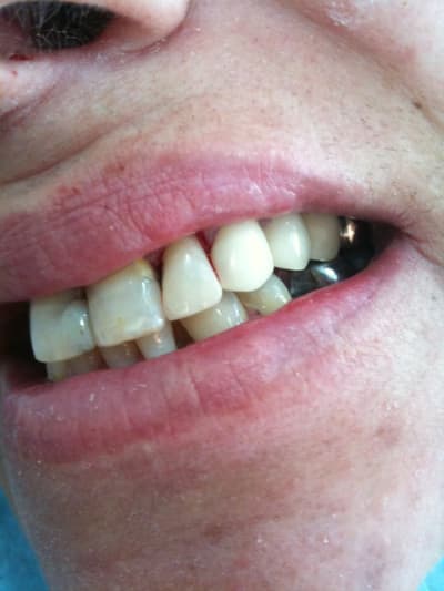 014 i9wylv - Eugenol