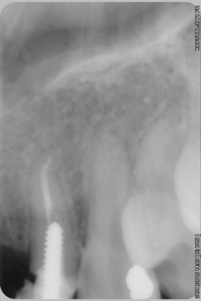 016copier zr2pom - Eugenol