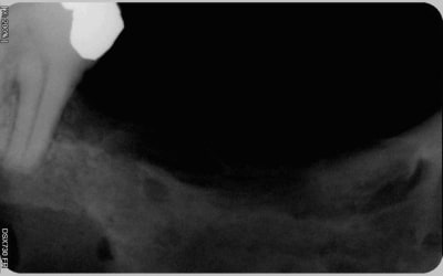 019 a9ouhm - Eugenol